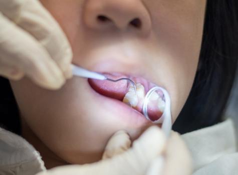 Children's dentist examining a child's teeth