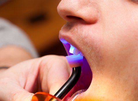 Close up of dental patient getting cosmetic dental bonding