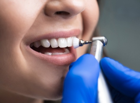 Dentist performing a teeth cleaning on a patient