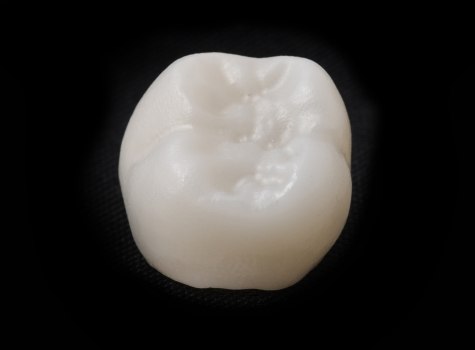 Dental crown against black background