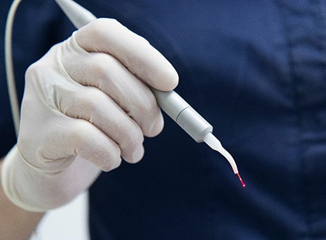 Dental lasers are soft-tissue lasers that can streamline oral health treatments