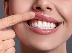 The soft tissue laser can be used to remove excess tissue and reshape the gums during your gum recontouring treatment