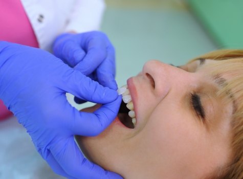 Cosmetic dentist placing veneer on a patient's tooth