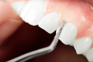 Close-up of gum examination