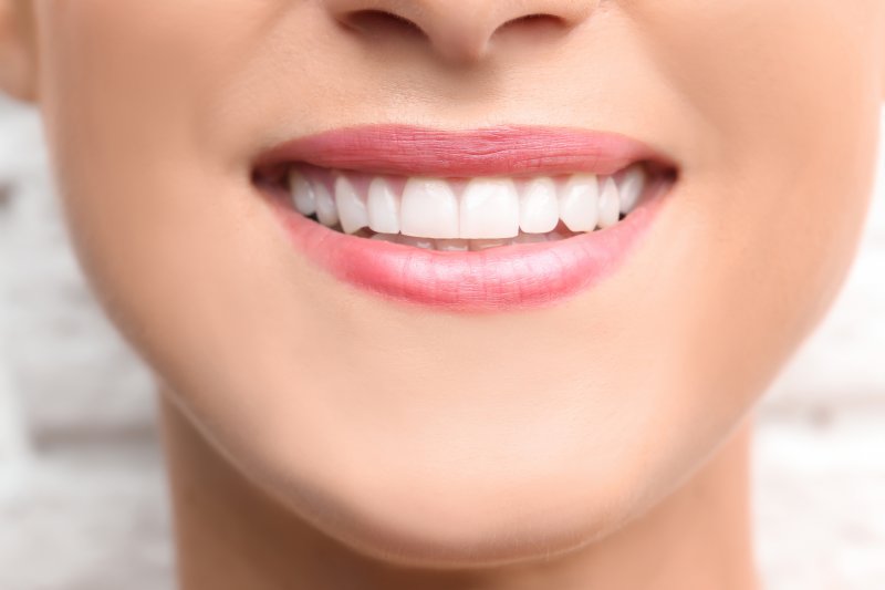 closeup of woman smiling after cosmetic dental bonding in Hoover