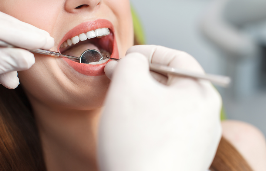Close up of woman's mouth at dental exam