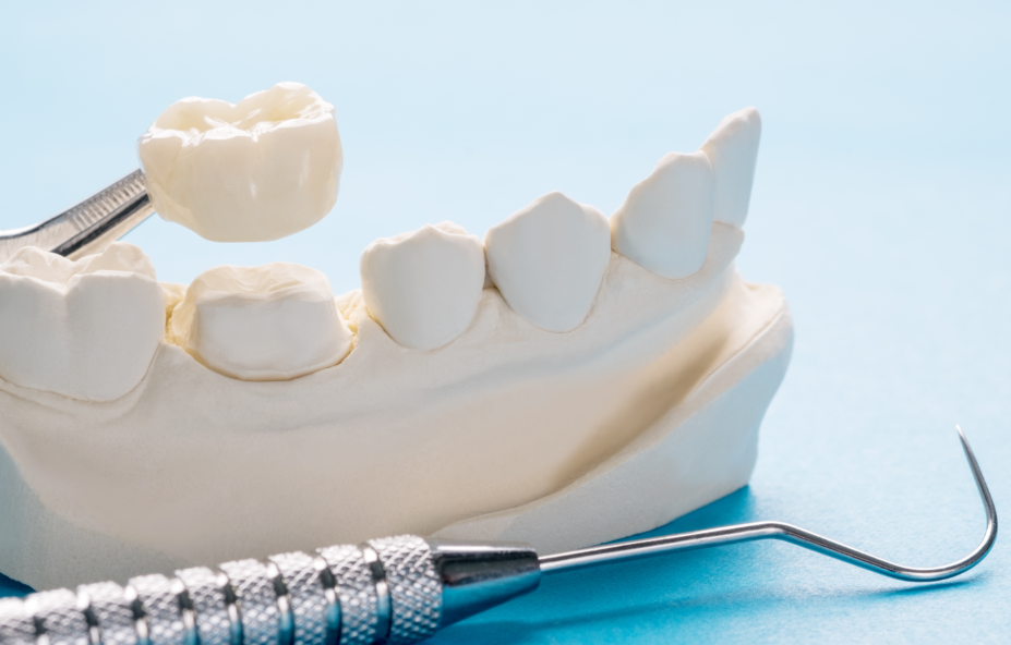 Dental crown with tools 