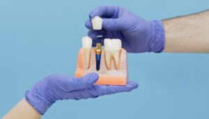 Two gloved hands holding model of dental implant.
